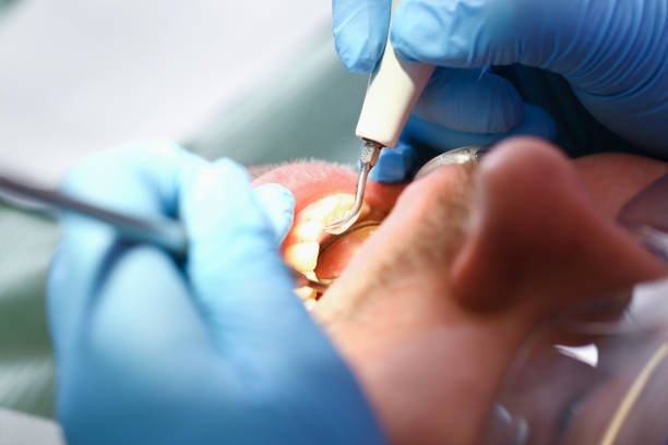 Best Weekend Emergency Dentist in Mcadenville, NC