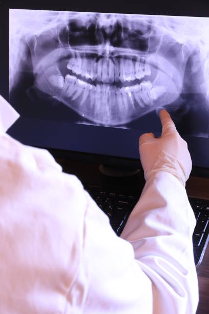 Best Emergency Tooth Extraction in Mcadenville, NC